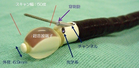 超音波気管支鏡 超音波気管支鏡