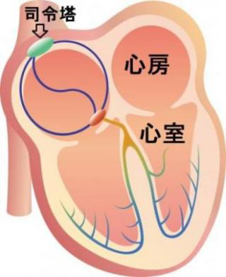 1 心臓のイメージ図
