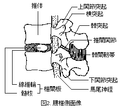 腰椎側面像 腰椎側面像