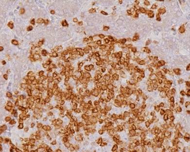 肝臓の切片を抗CD3免疫染色し、顕微鏡で拡大した画像です。